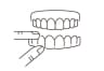 Invisible Aligners