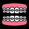 Traditional Metal Braces