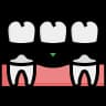 Dental Crowns