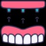 Dentures