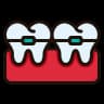 Dental Bridges