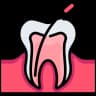 Root Canal Therapy